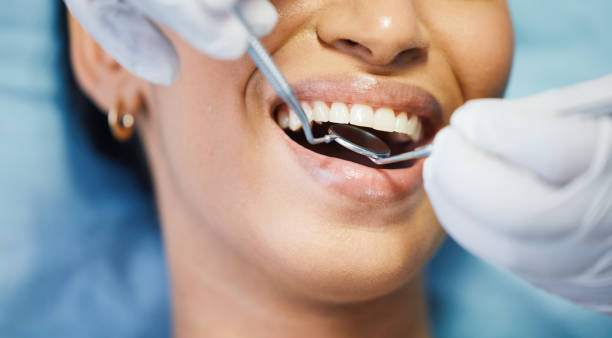 Best Emergency Dental Extractions in Sumner, WA